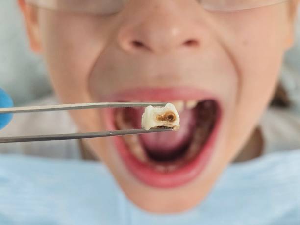 Best Broken Tooth Emergency  in Milton, WV